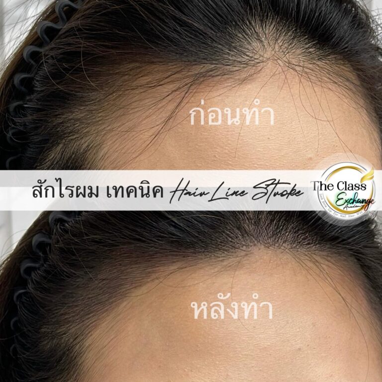 สักไรผม-06
