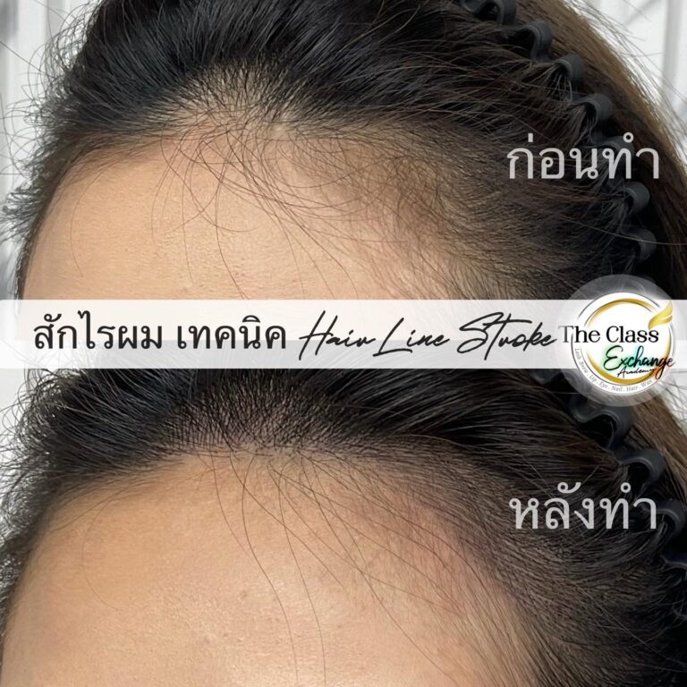 สักไรผม-07